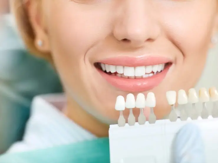 Teeth Whitening at Pomerado Family Dental