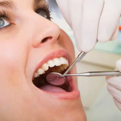 Dental Filling in Pomerado Family Dental