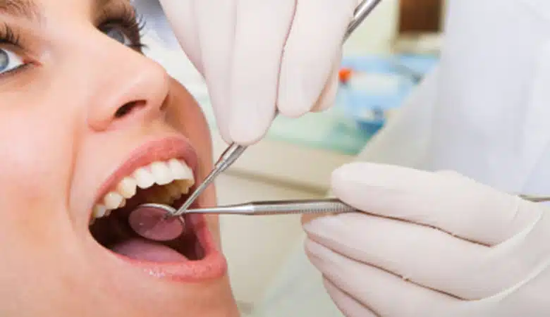 Image of Teeth Whitening
