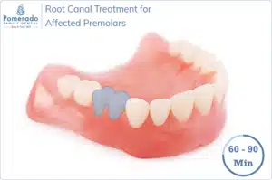 How long does Root Canal Take to treat Premolars